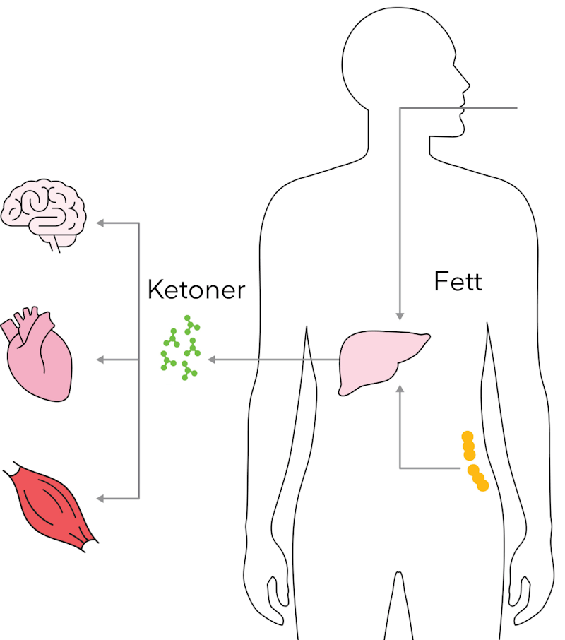 ketosis