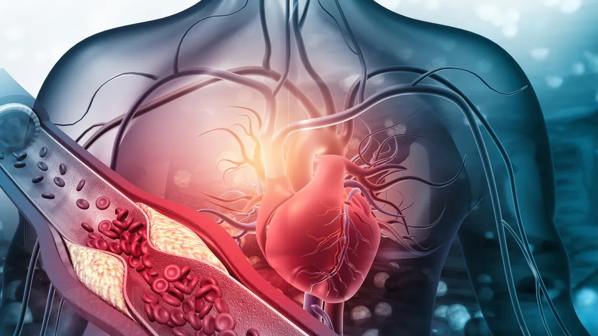 Kolesterol – ett fett ämne