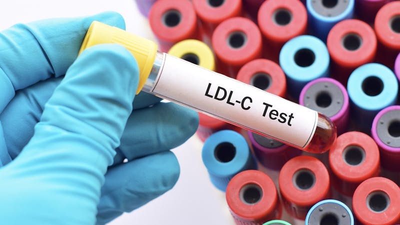Test tube with blood sample for LDL cholesterol test