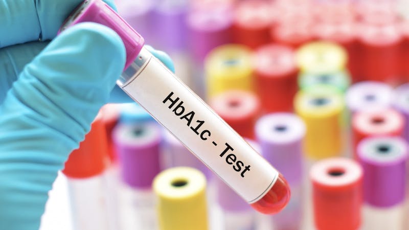 Blood sample for HbA1c test, diabetes diagnosis