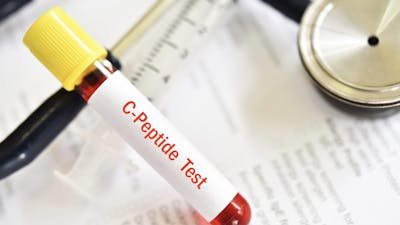 Varför är inte c-peptid ett standardtest för insulinresistens?