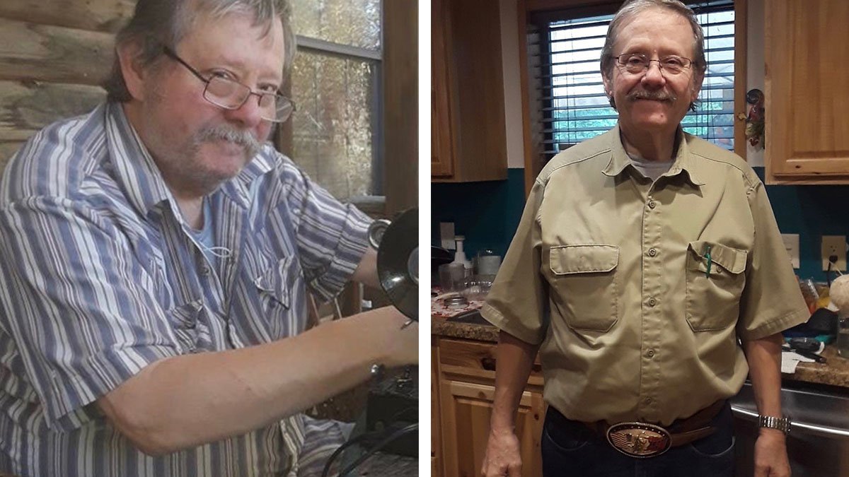 James kunde sluta med insulin efter 20 år med typ 2-diabetes