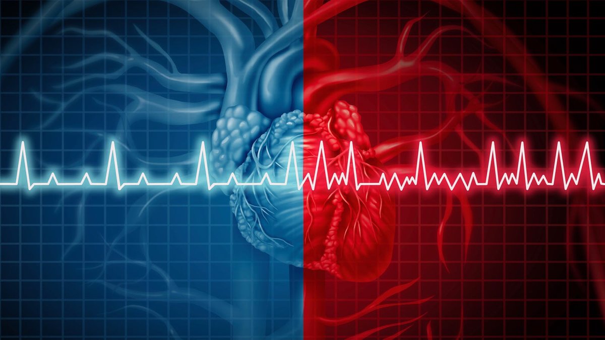 Felaktig nyhetsrapportering menar att LCHF kan orsaka förmaksflimmer