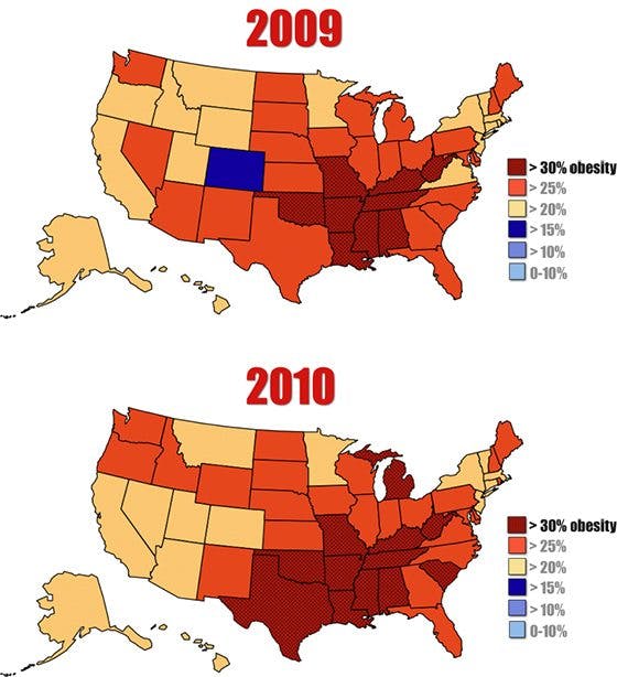 Obesity An American Epidemic