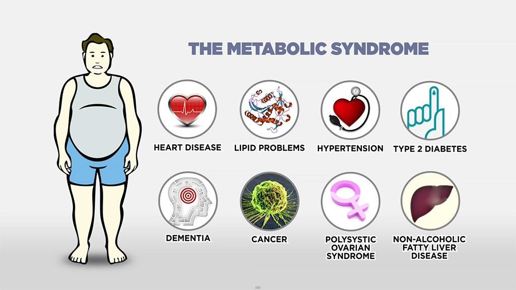 Marvelous new video on obesity