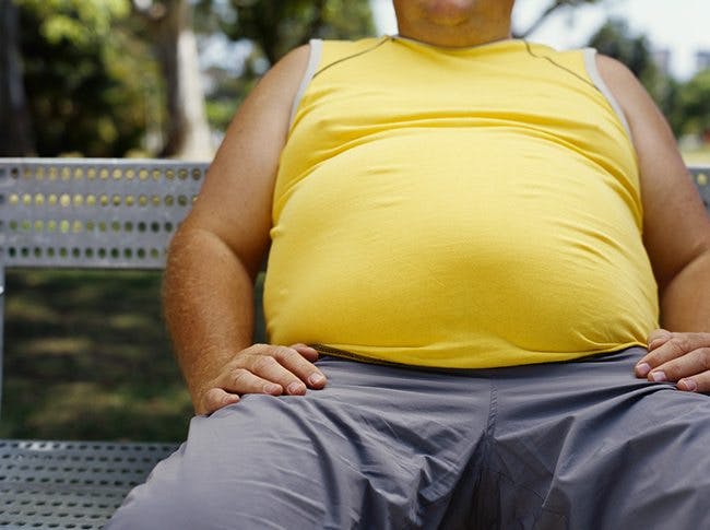 obesity