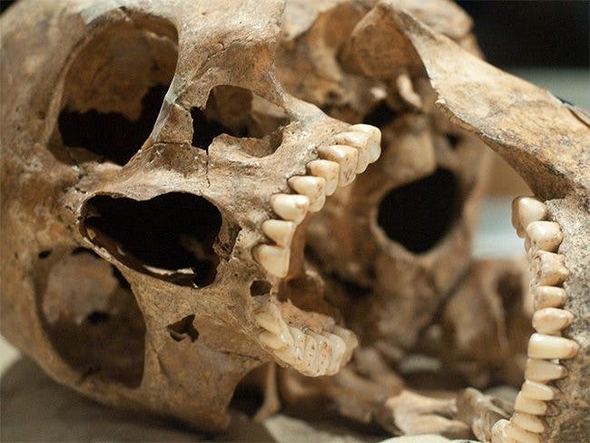 teeth