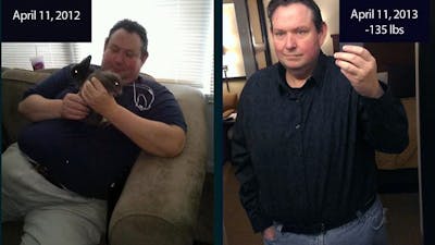 Losing 135 pounds in one year with LCHF