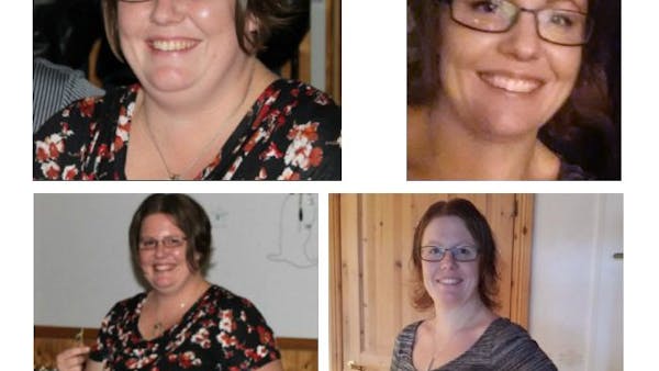 Instead of weight-loss surgery