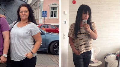 Is it possible to recover from hypothyroidism?