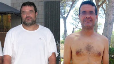 "My fatty liver is gone"