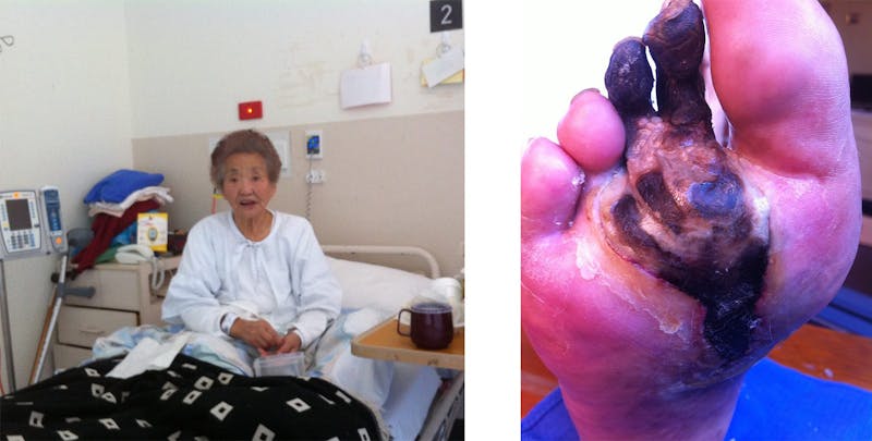 Mother in hospital with gangrene
