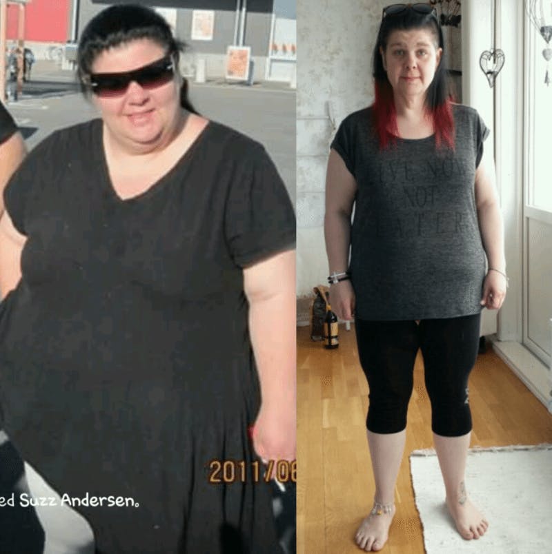 Losing 140 pounds with fat Diet Doctor