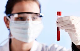 My health markers after 10 years on a low-carb, high-fat diet