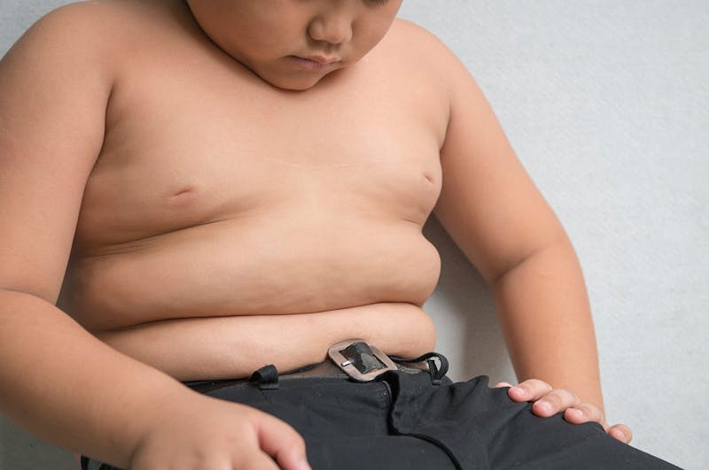 cild_obesity1