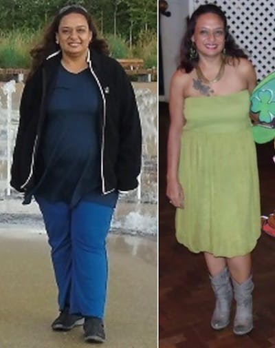 Before and after
