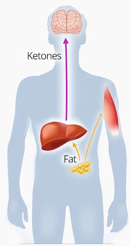 Ketosis