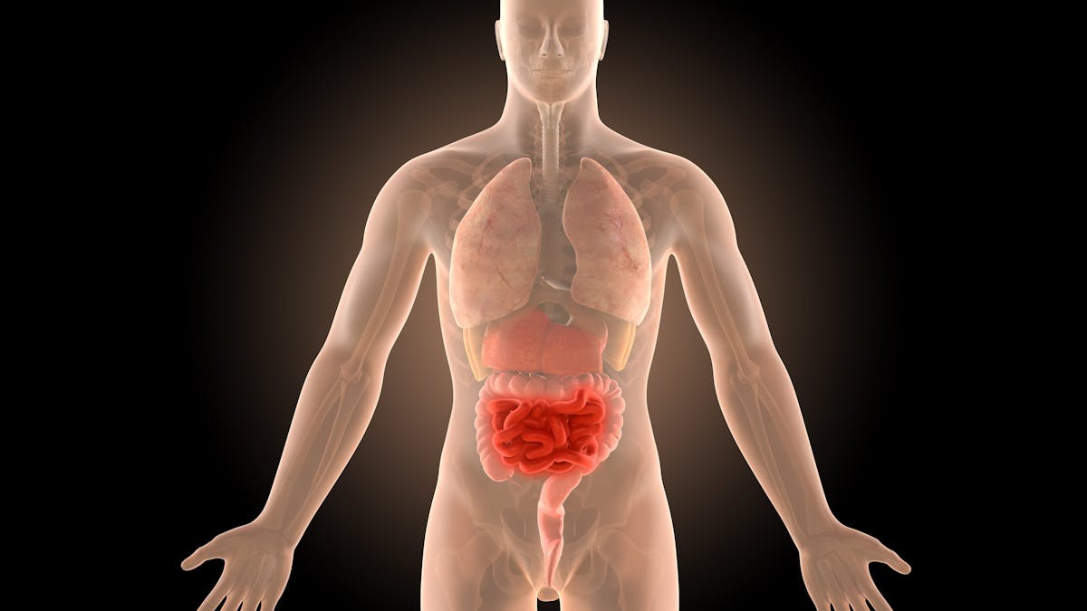 Crohn’s disease successfully treated with the paleolithic ketogenic diet