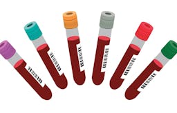 Fasting and cholesterol