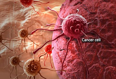 cancer-101-s1-what-is-cancer-cell-e1491583835843