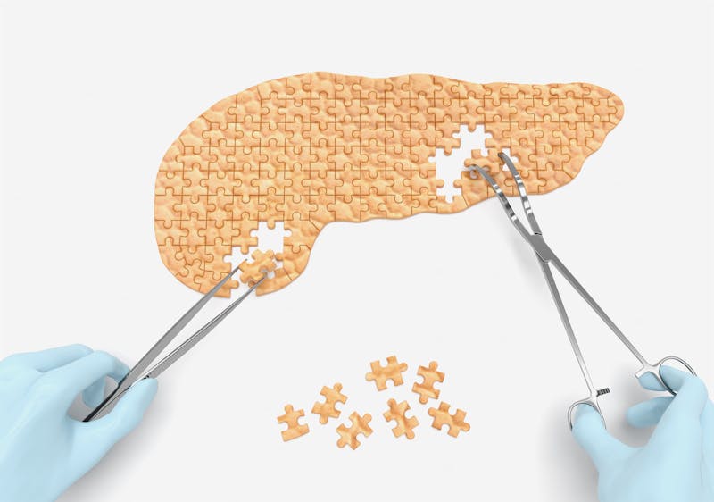 pancreas