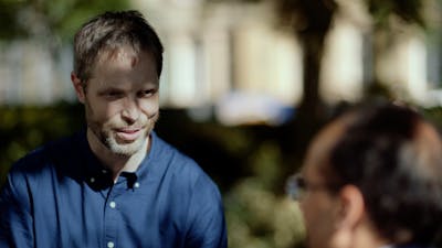 2型糖尿病的治疗非常简单