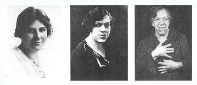 Acromegaly_classic_woman