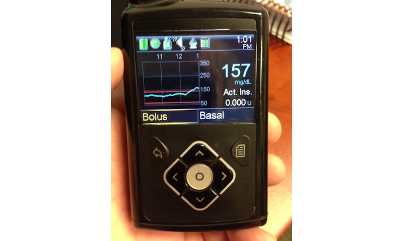 CGM