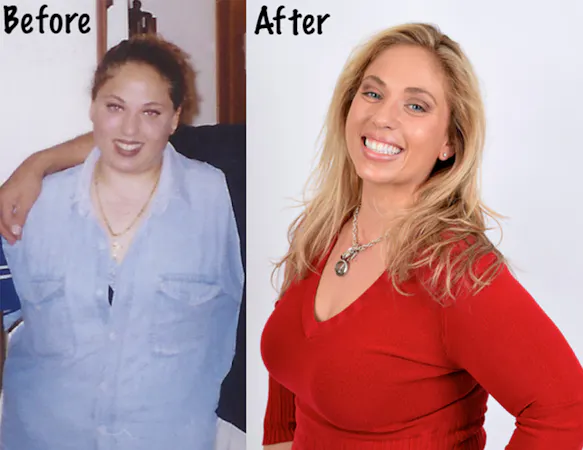 Maintaining a loss of over 100 pounds on a low-carb diet for 17 years