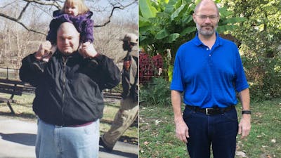 The keto diet: Maintaining a 150-pound loss for 10 years