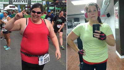 “I had been trying to lose weight since the age of 9. And they told me all that I had left was bariatric surgery”