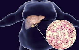 Groundbreaking study: low carb is an effective treatment for fatty liver