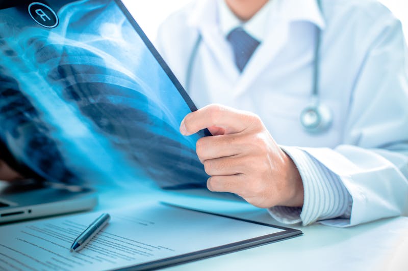 close up of male doctor holding x-ray or roentgen image