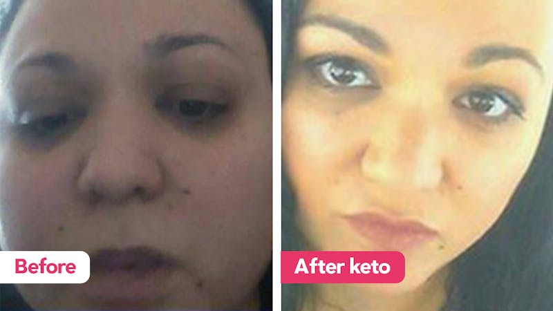 kellie-before-after