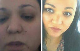 The keto diet: "I have come back from the dead"