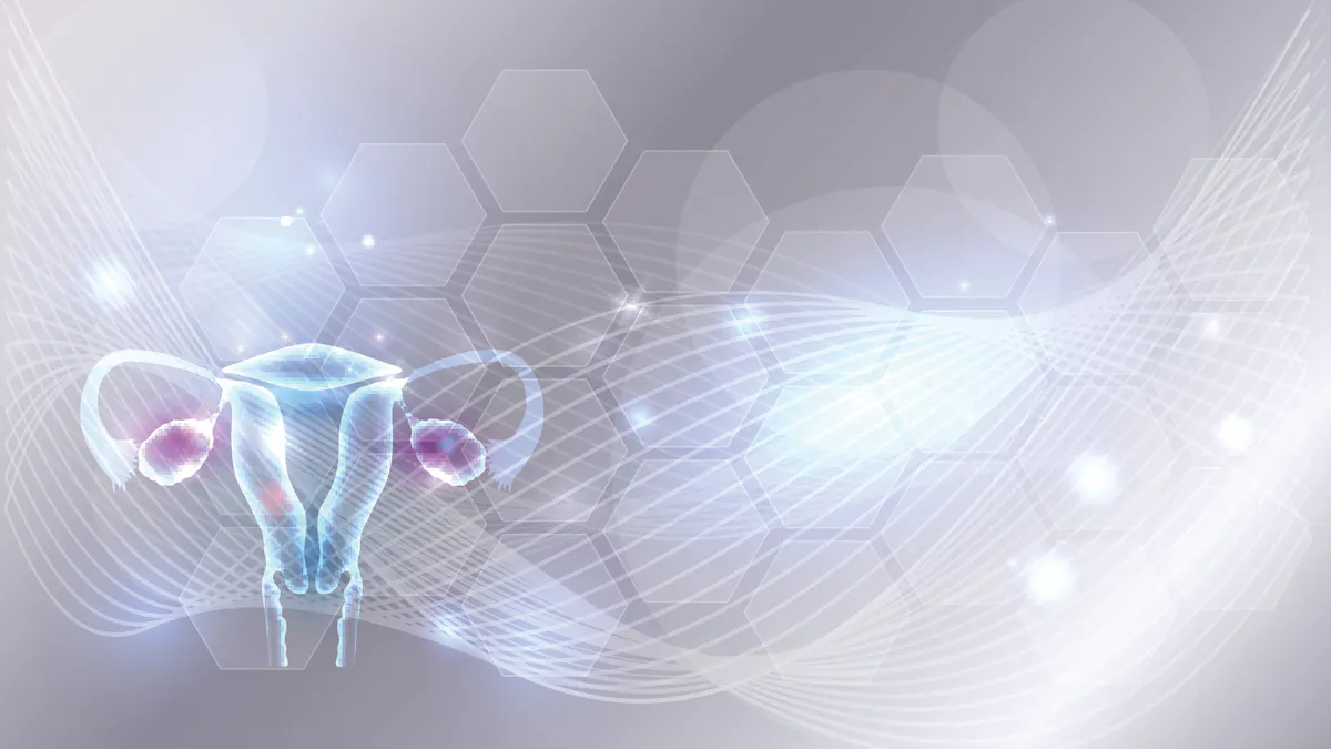 Hyperandrogenism – PCOS 3