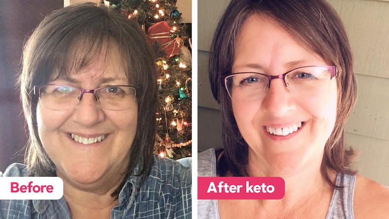 The keto diet: The keto diet:
