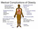 Medical complications of obesity
