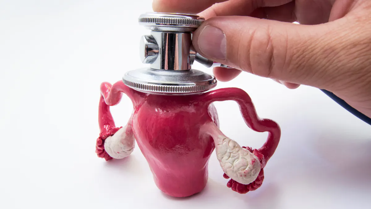 PCOS, anovulatory cycles and hyperinsulinemia – PCOS 9