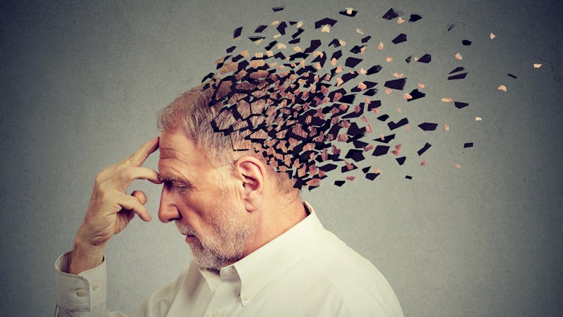 Memory loss due to dementia. Senior man losing parts of head as symbol of decreased mind function.