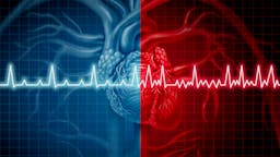 Inaccurate news stories suggest low carb causes atrial fibrillation