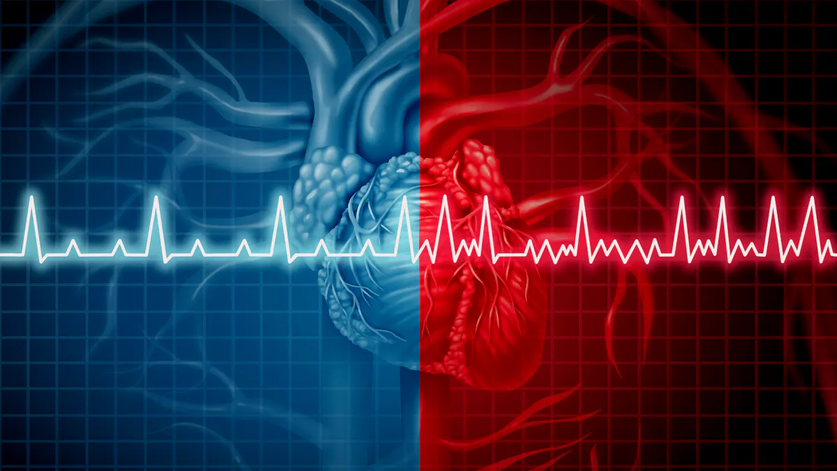 Inaccurate news stories suggest low carb causes atrial fibrillation