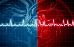 Inaccurate news stories suggest low carb causes atrial fibrillation