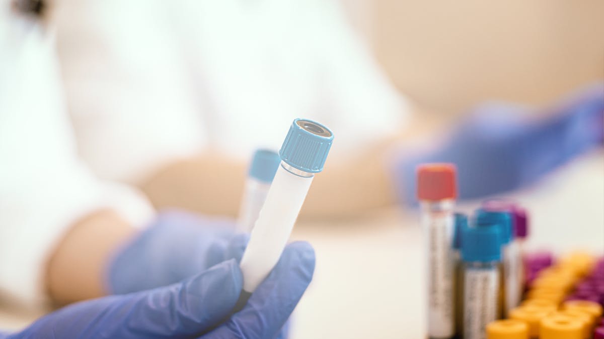 What happens when health markers and lab results do not improve on a low-carb diet?