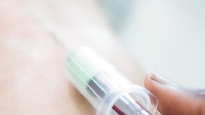 How to lower LDL cholesterol on a low-carb diet