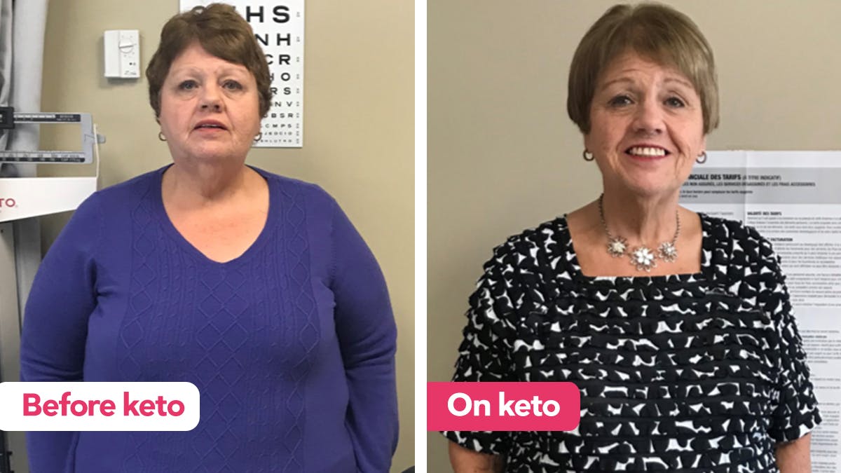 Nicole’s case: keto solves lifelong obesity and food issues