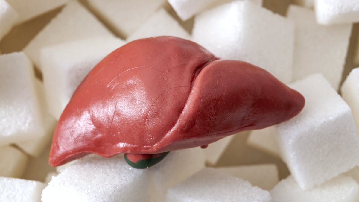 Saturated fat vs. sugar: What is the cause of fatty liver?