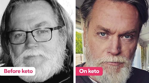 'I've lost 100 pounds and no longer have type 2 diabetes'