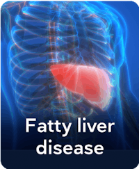 fatty-liver-disease