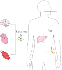 ketosis